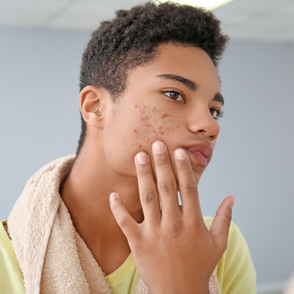 AviClear™ vs. TheraClearX vs. Cool Peel: Which Skin Clearing Treatment is Right for You?